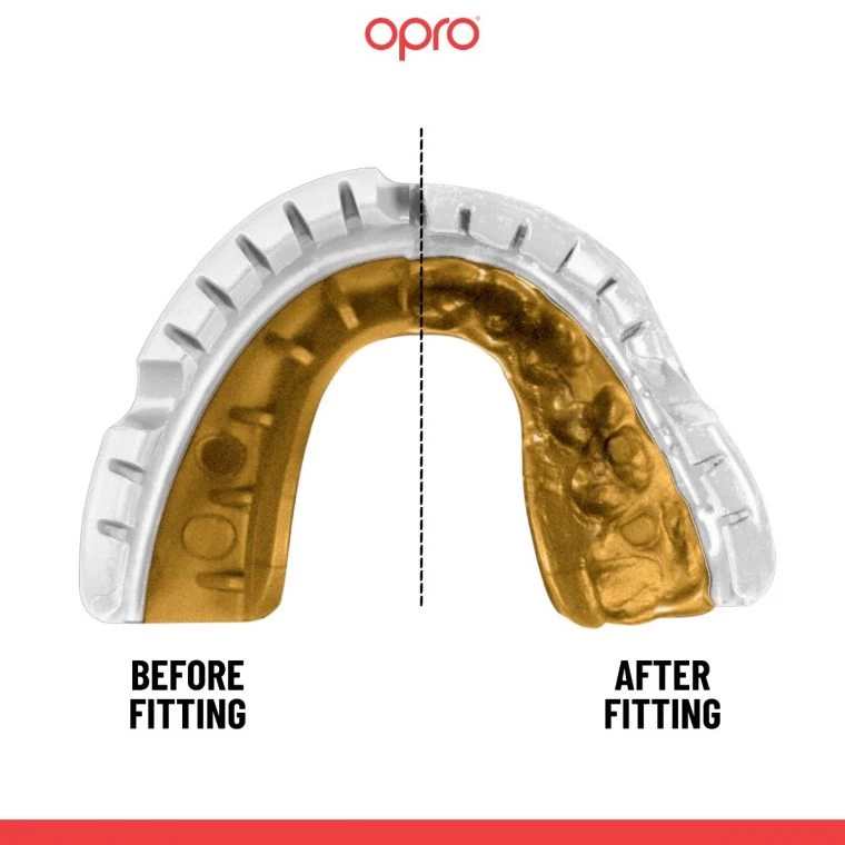 OPRO - ADULT GOLD MOUTHGUARD FOR BRACES (WHITE) 2 OPRO - ADULT GOLD MOUTHGUARD FOR BRACES (WHITE) - Image 2